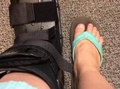 Back Square Possible Stress Fracture… Round