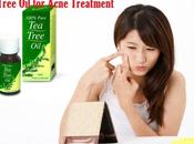Tree Cure Prevent Acne