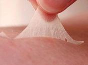 Sunburn? Tips Precautions Remove Peeling Skin Smoothly