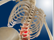 Study Shows Chiropractic Best Choice Athletes with Back Pain