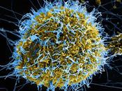 Avoid Ebola Contamination