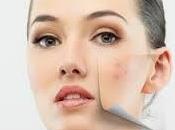 Five Best Anti Pigmentation Products India