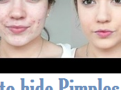 Hide Pimples with Makeup: Tutorial+Video