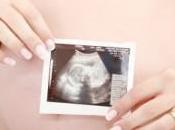Ultrasound Scan: Your Baby Before Arrives