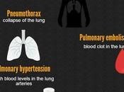 Chest Pain Medical Causes