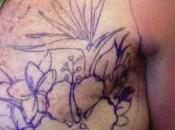 Tattoo Rather Than Reconstruction