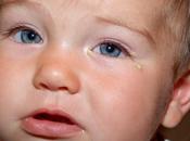 Conjunctivitis Types Symptoms