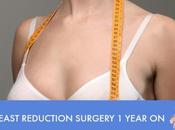 Breast Reduction Update Year