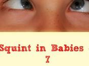 Squint Babies Things Need Know