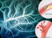 Recognize Signs Stroke