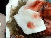 Baltimore Black “teens” Beat Y.o. White Almost Death