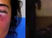 When Polar Bears Fight Back