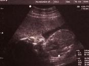 Preggy Diary Finally Baby Gender Revealed!!