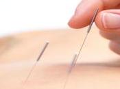 Acupuncture Male Fertility Dublin