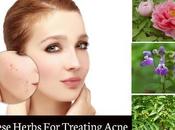 Chinese Herbs Treating Acne