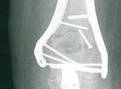 X-rays Wife's Shattered Provide Dramatic Evidence Trauma Rogue Cops Leave Behind