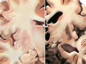 Frightening: Alzheimer’s Transmitted