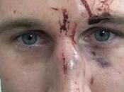 Chicago Way: Staple Forehead