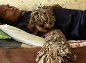 Treeman Indonesia- DeDe Kosawa