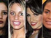 Insanity: People Deform Themselves with Plastic Surgery