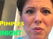 Blind Acne Pimples Fast Overnight