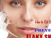 Prevent Flaky Skin: Home Remedies