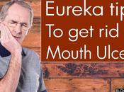 Eureka Tips Mouth Ulcers