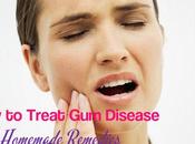 Treat Disease: Best Homemade Remedies