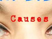 Eyes Causes Natural Home Remedies Treating