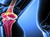 Manipal Hospital Bangalore India Offers Cost Knee Replacements Surgery Fight from Osteoarthritis