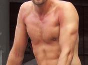 Open Post: Hosted Alexander Skarsgard’s Sunburnt Nips