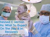 Planned Section Births: What Expect Recovery