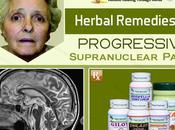Ayurvedic Treatment Progressive Supranuclear Palsy (PSP)