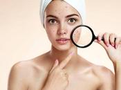 Surprising Things That Make Your Skin Break Out!