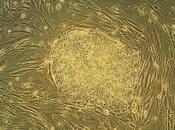 Stem Cells What Cells, Types Advantages Cell Treatment.