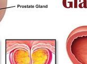 Amazing Superfoods Prevent Enlarged Prostate