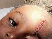 Little Brutally Injured Classmate Refusing Share Breakfast With (Graphic Photos)