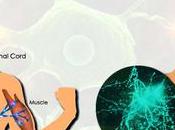 There Solution Amyotrophic Lateral Sclerosis?Treatment Management