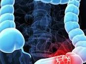 What Early Symptoms Causes Colon Cancer!