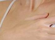 Home Remedies Lighten Dark Underarms