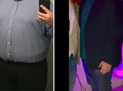 Jose’s Gastric Sleeve: Life Changing