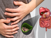 Herbal Remedies Work Gall Stones