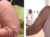 Anita Transitioned Keto Diet Changed Life