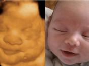 Truth Behind “Baby With Nose” Ultrasound!