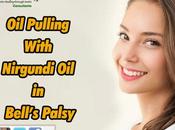 Pulling With Nirgundi Bell’s Palsy