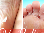 What Causes Skin Peeling Hands