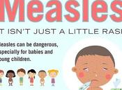 Measles Symptoms, Treatments Reasons
