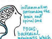 Meningitis: Symptoms Treatment More Info