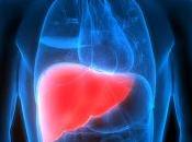 Liver Cirrhosis Find Causes Symptoms