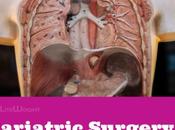 Bariatric Surgery Your Liver